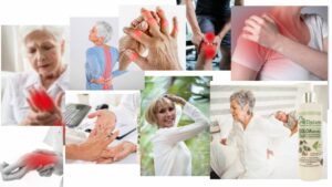 dolo arthritis cream
